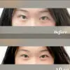 image shows before and after effect of under eye mask